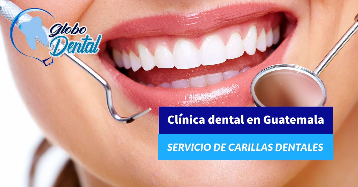 Clínica dental en Guatemala Servicio de Carillas Dentales estéticas