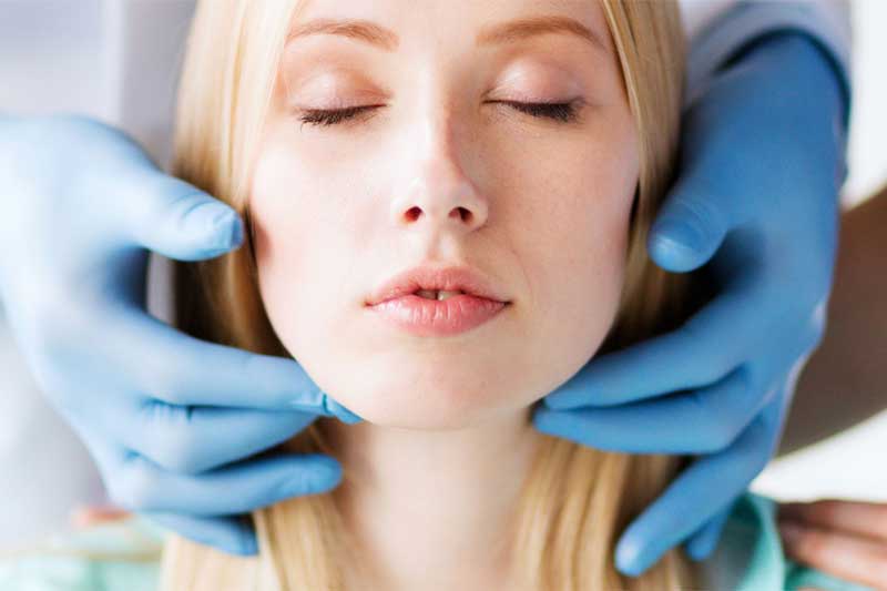 Clínica dental en Guatemala-Bichectomia o eliminación de bolas de Bichat