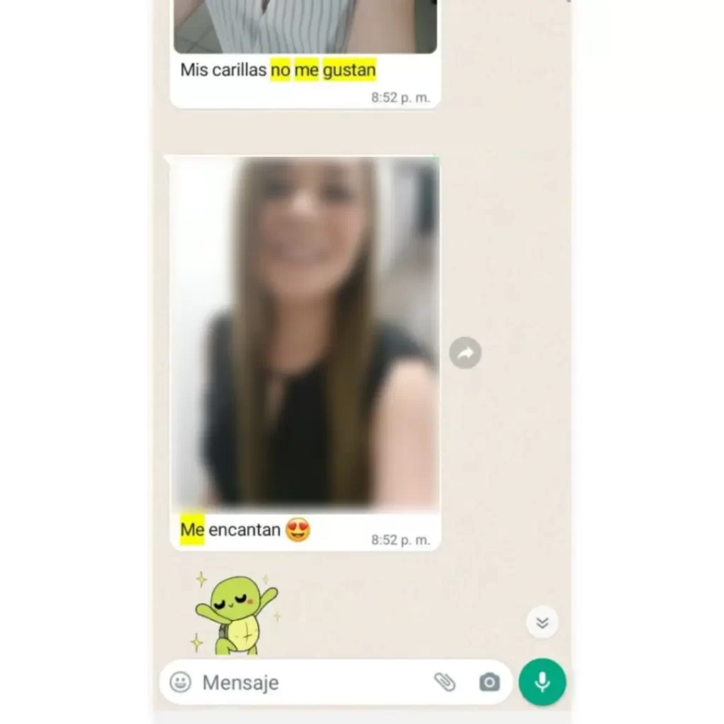 Resultado de carillas dentales