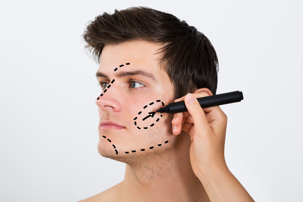 Bichectomia en hombres: Una cirugía en auge