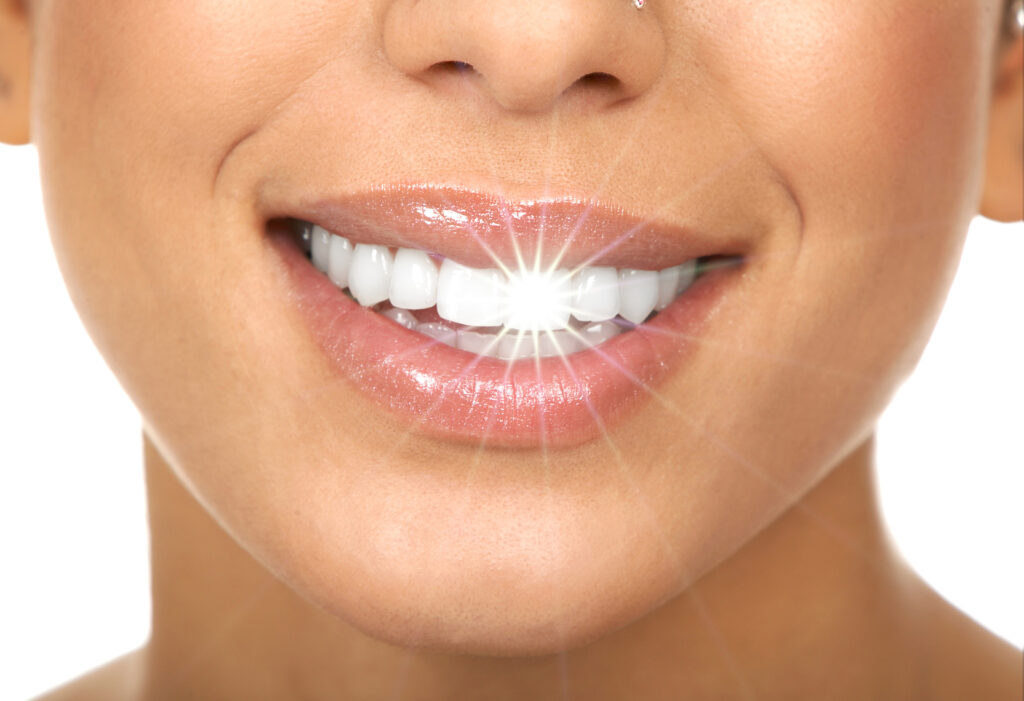 Clínica dental en Guatemala-Diseño de sonrisa profesional