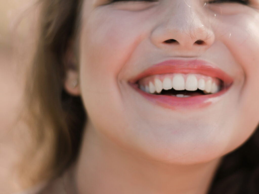 Carillas Dentales: Equilibrio Estético y Funcional