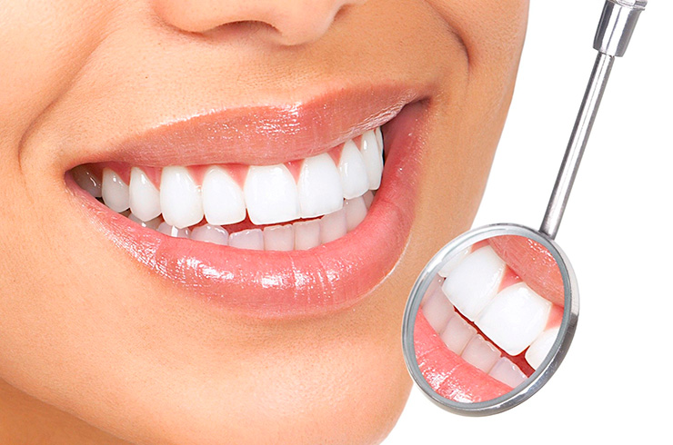 Implantes Dentales: Ventajas y desventajas