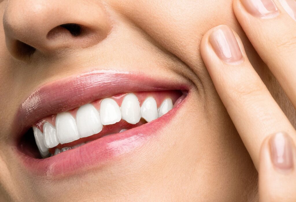 Clínica dental en Guatemala-Diseño de sonrisa no invasivo