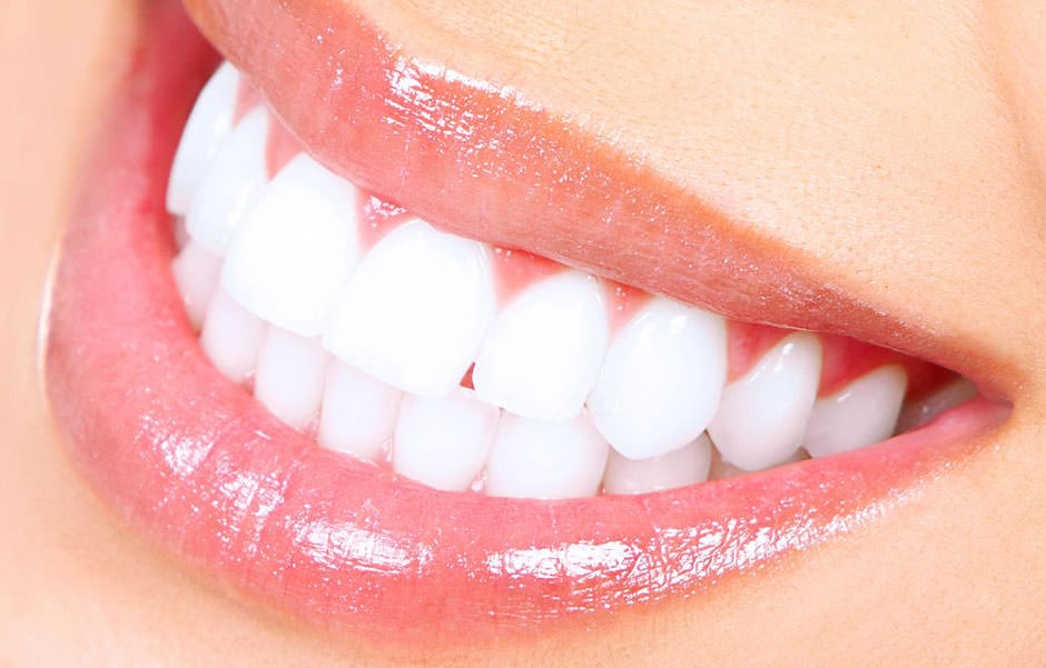 Diseño de sonrisa de mujer
