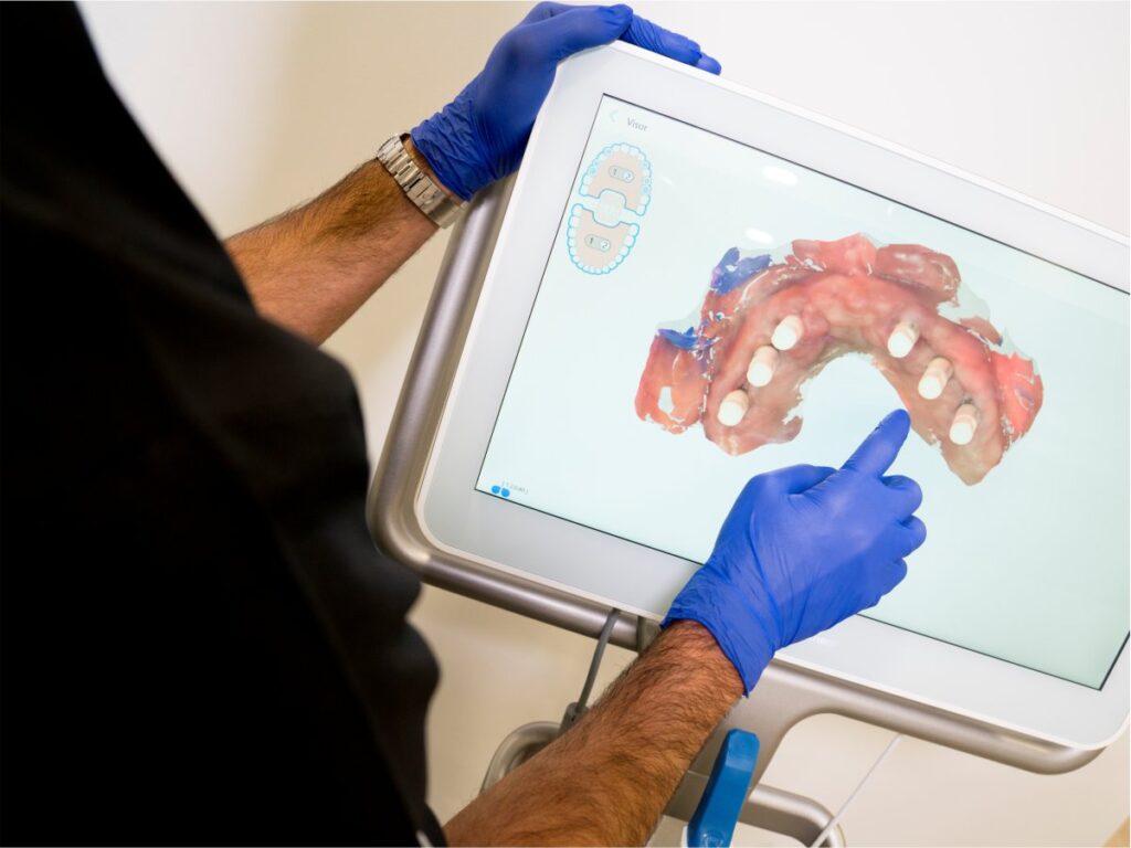 Sonríe con Confianza: Descubre todo sobre Implantes Dentales