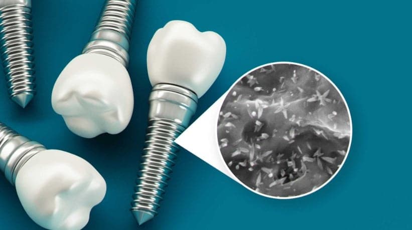 Clínica dental en Guatemala