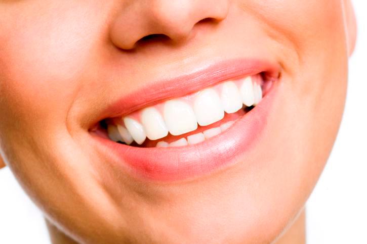 Clínica dental en Guatemala-Servicio de Diseño de Sonrisa