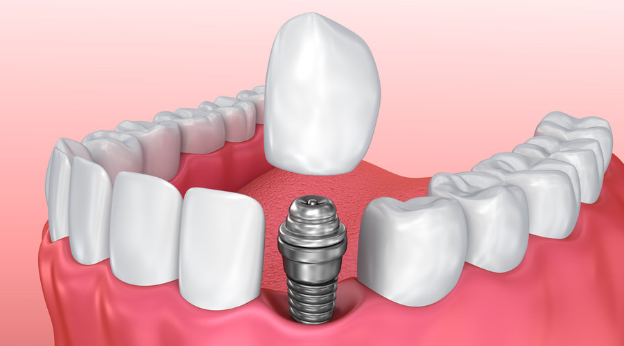 Clínica dental en Guatemala