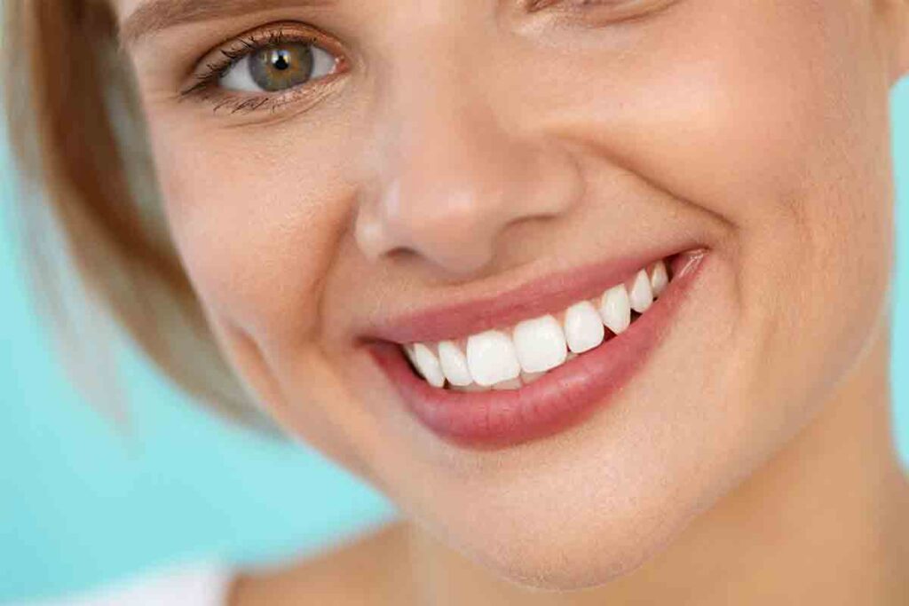 Clínica dental en Guatemala-Servicio de Carillas Dentales en adultos