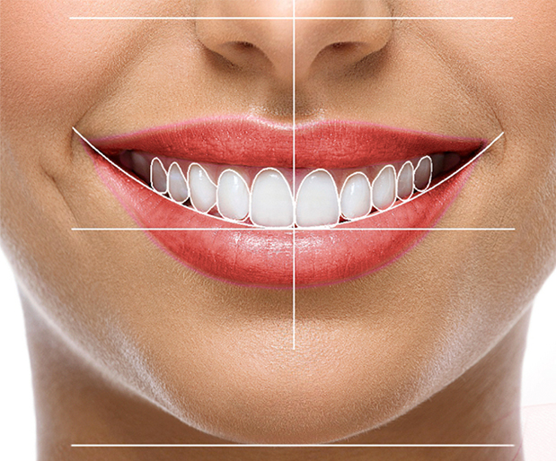 Tipos de Diseño de Sonrisa