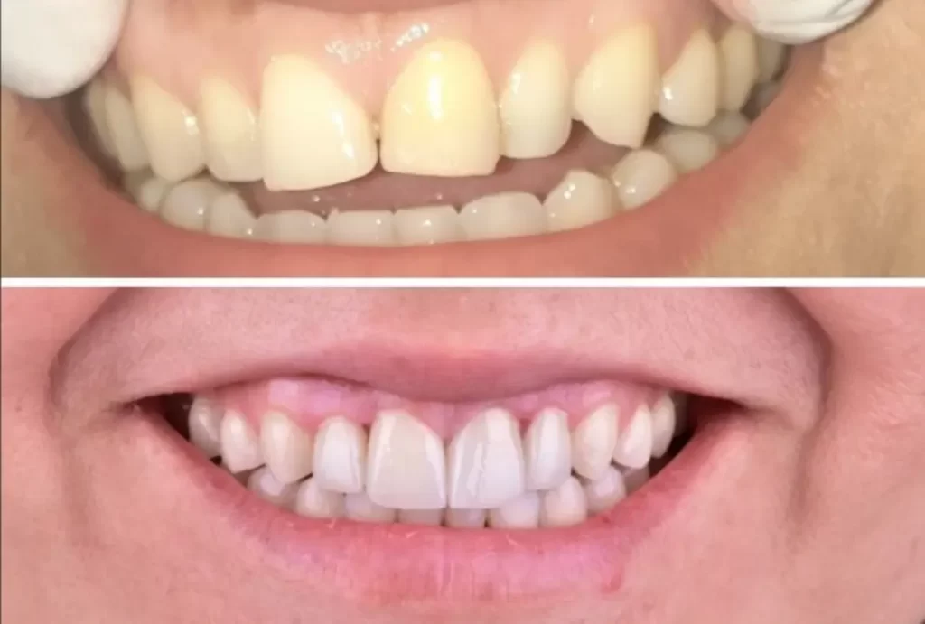 Clínica dental en Guatemala