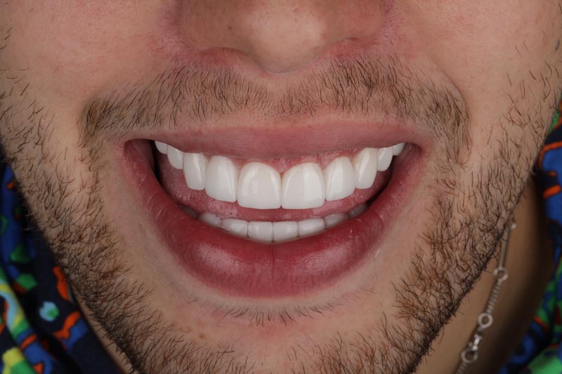 Sonrisa de hombre
