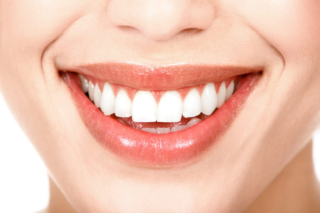 Sonrisa perfecta