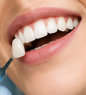 Estética dental en Guatemala