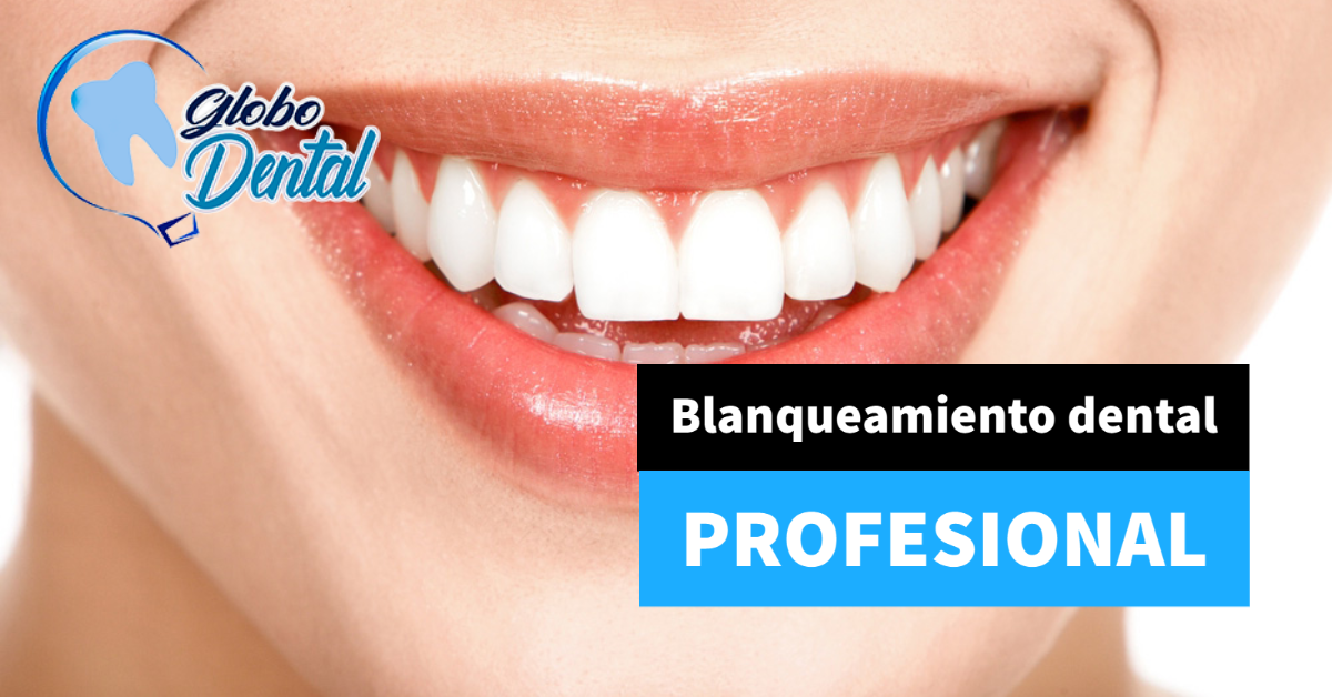 Blanqueamiento dental Profesional
