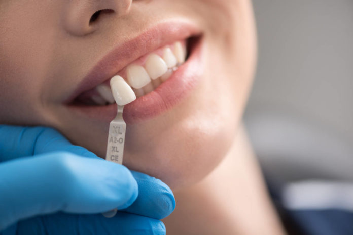 Paciente que requiere implante dental