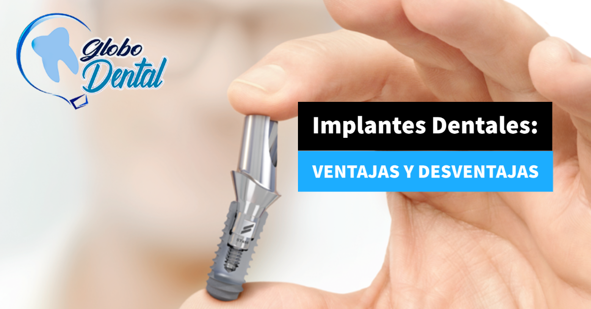 Implantes Dentales: Ventajas y desventajas
