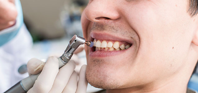 Realización de limpieza dental