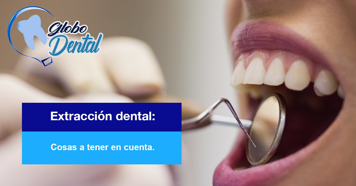 Extracción dental: Cosas a tener en cuenta.