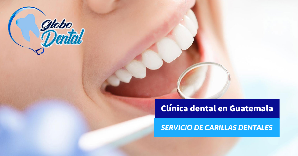 Clínica dental en Guatemala Servicio de Carillas Dentales