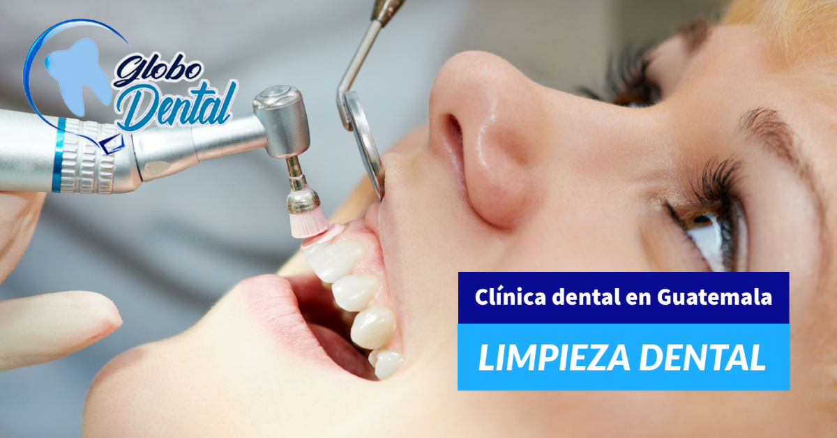 Clínica dental en Guatemala Servicio de Limpieza dental