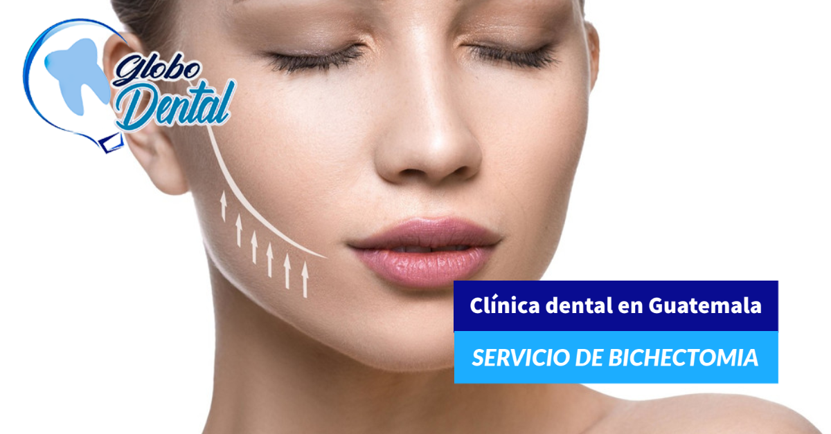 Clínica dental en Guatemala-Servicio de Bichectomia