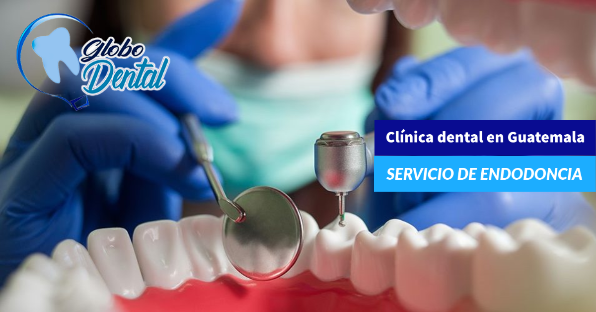 Clínica dental en Guatemala-Servicio de Endodoncia
