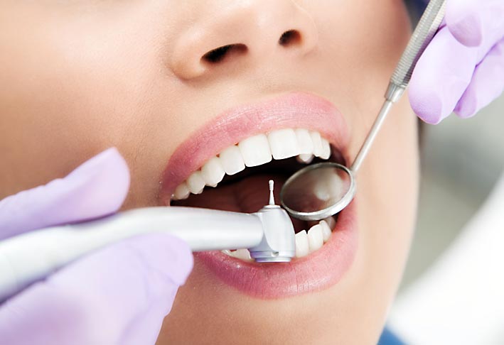 Procedimiento de limpieza dental
