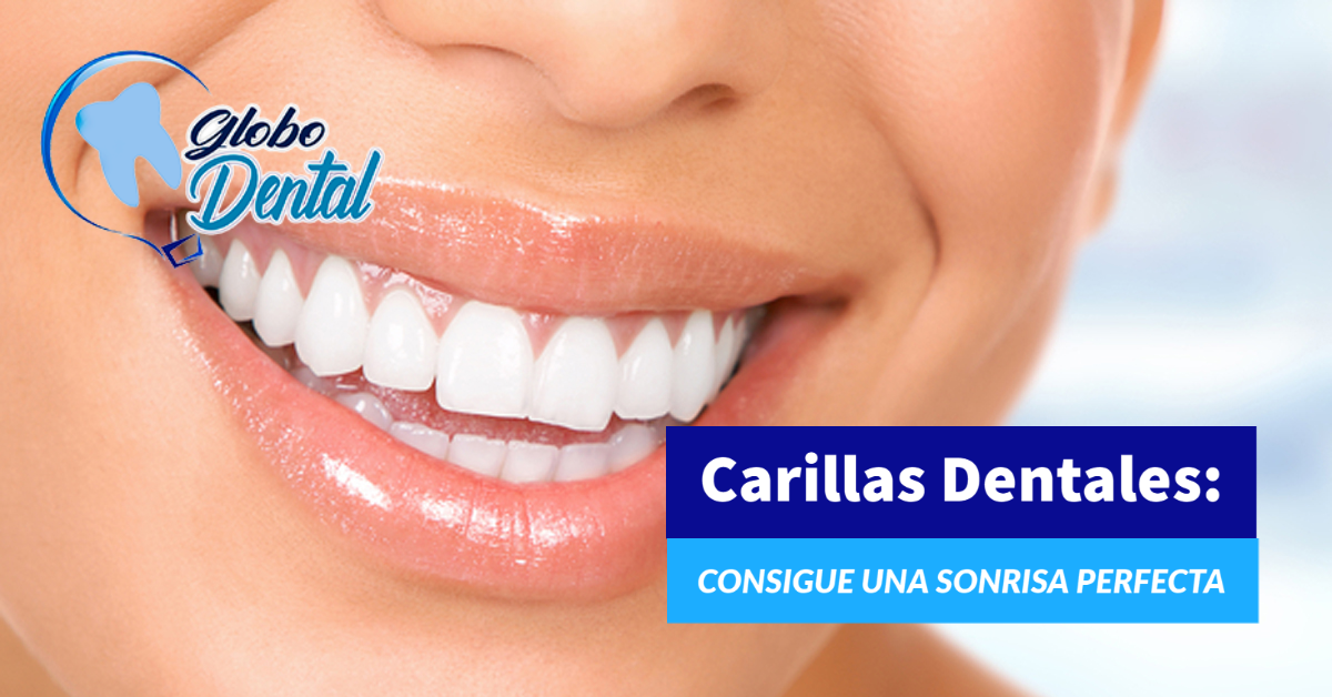 Carillas Dentales: Consigue una sonrisa perfecta