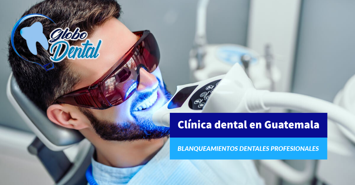 Clínica dental en Guatemala-Blanqueamientos dentales profesionales