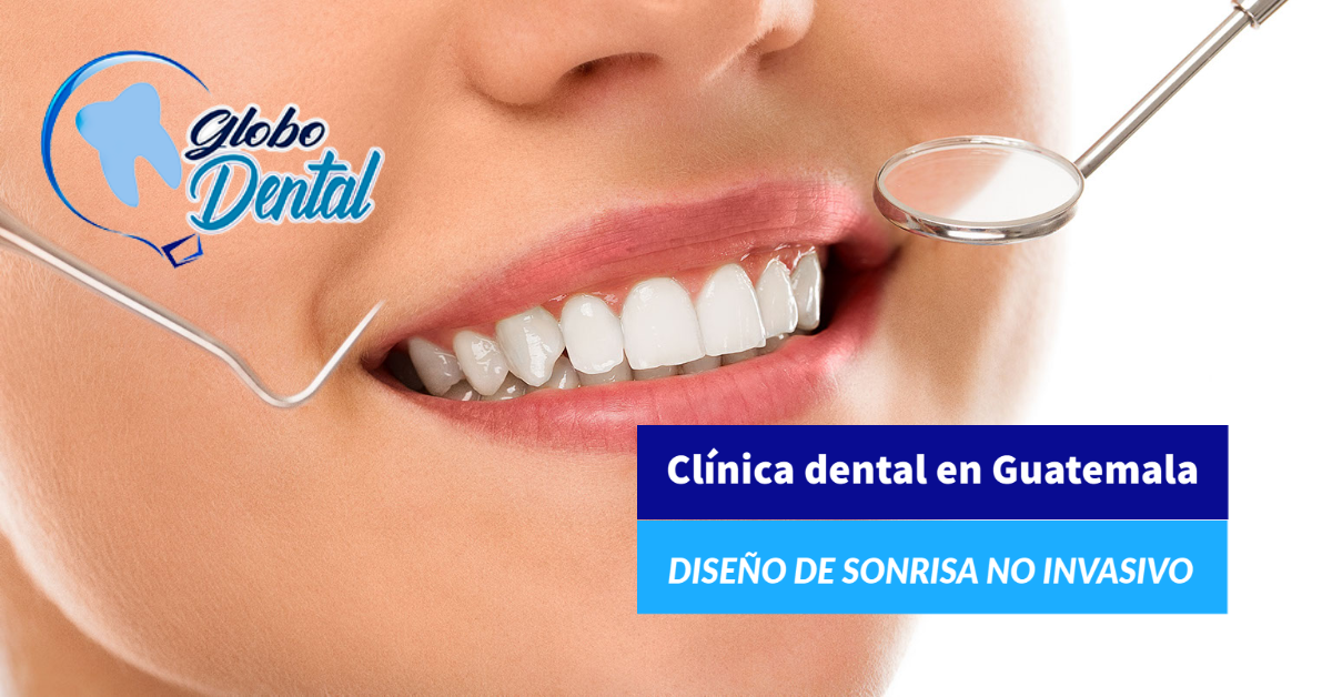 Clínica dental en Guatemala-Diseño de sonrisa no invasivo