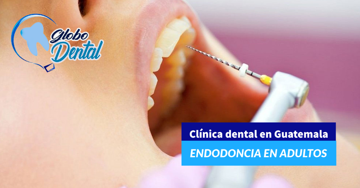 Clínica dental en Guatemala-Servicio de Endodoncia en Adultos