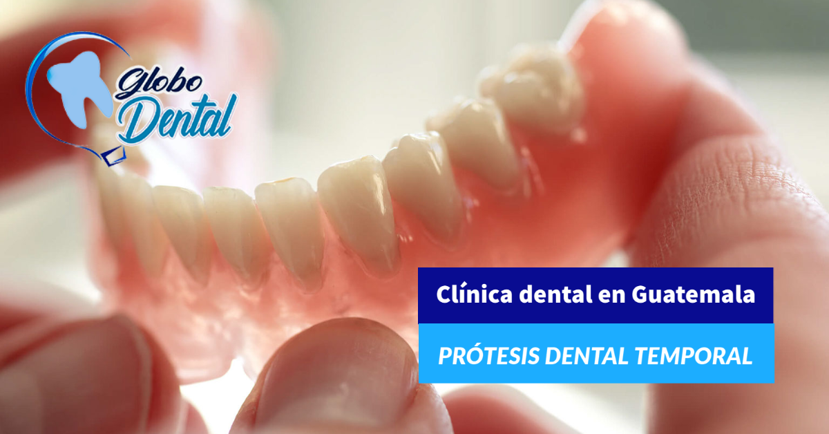 Clínica dental en Guatemala-Servicio de prótesis dental temporal