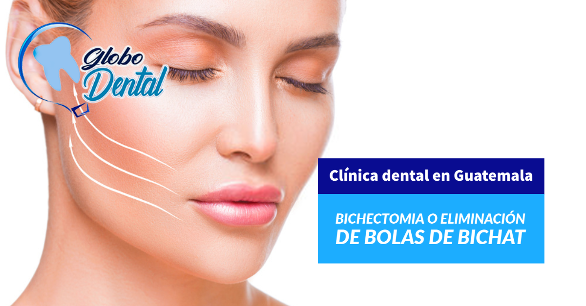 Clínica dental en Guatemala-Bichectomia o eliminación de bolas de Bichat