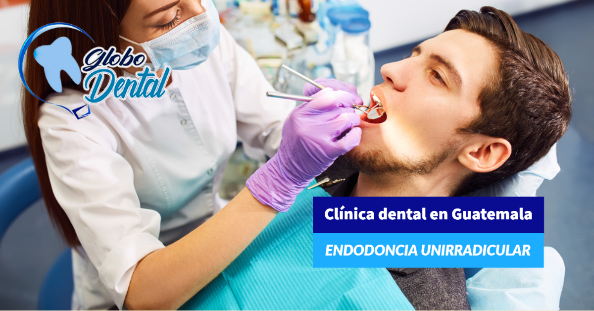 Clínica dental en Guatemala-Endodoncia unirradicular