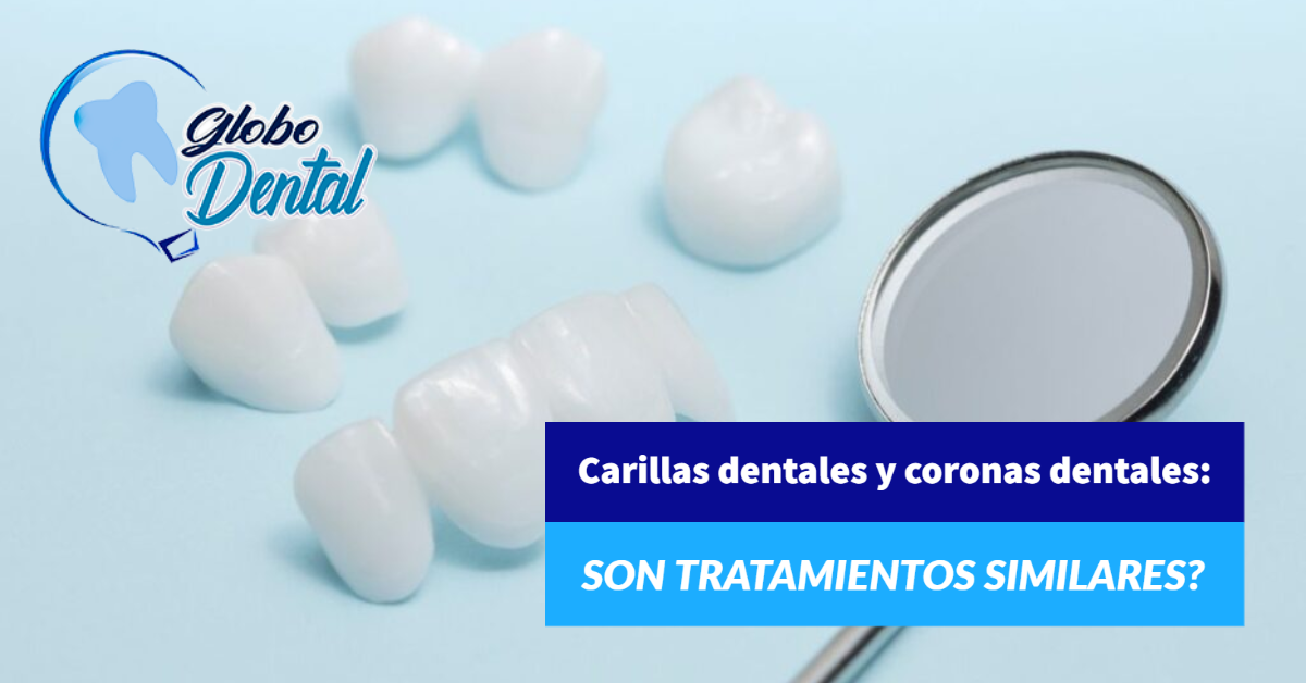 Carillas dentales y coronas  dentales: Son tratamientos similares?