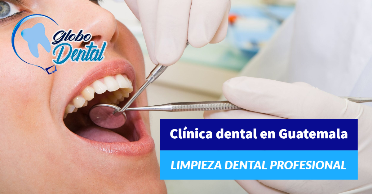 Clínica dental en Guatemala-Limpieza dental profesional