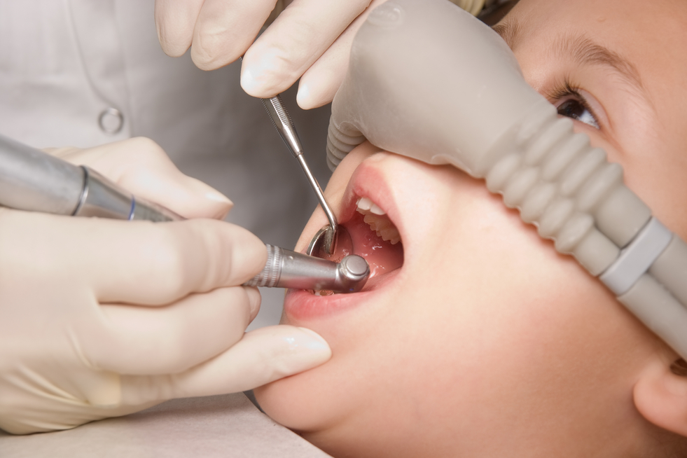 Efectos secundarios del óxido nitroso en odontología