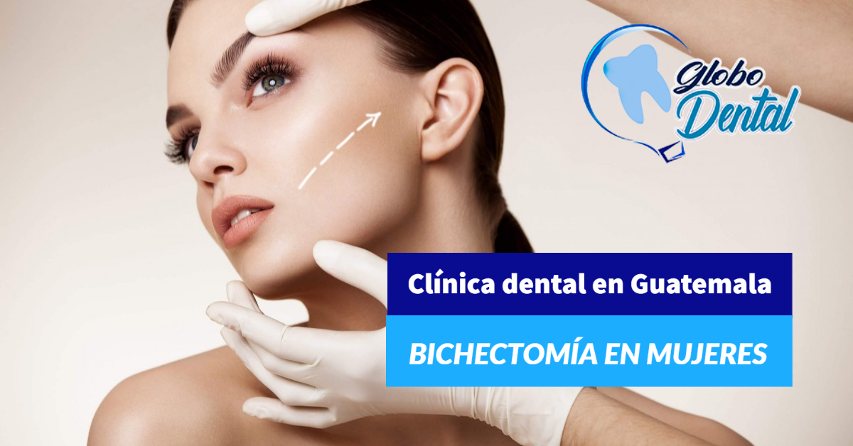 Clínica dental en Guatemala-Bichectomía en mujeres