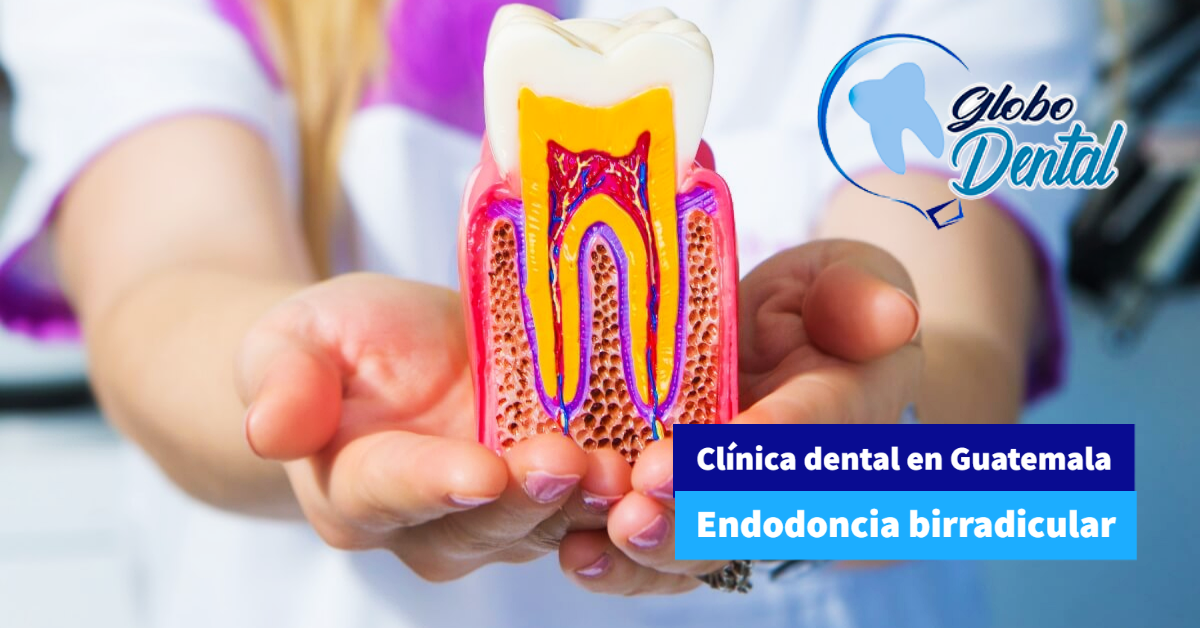 Clínica dental en Guatemala-Endodoncia birradicular