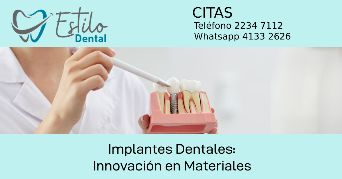 Implantes Dentales: Innovación en Materiales