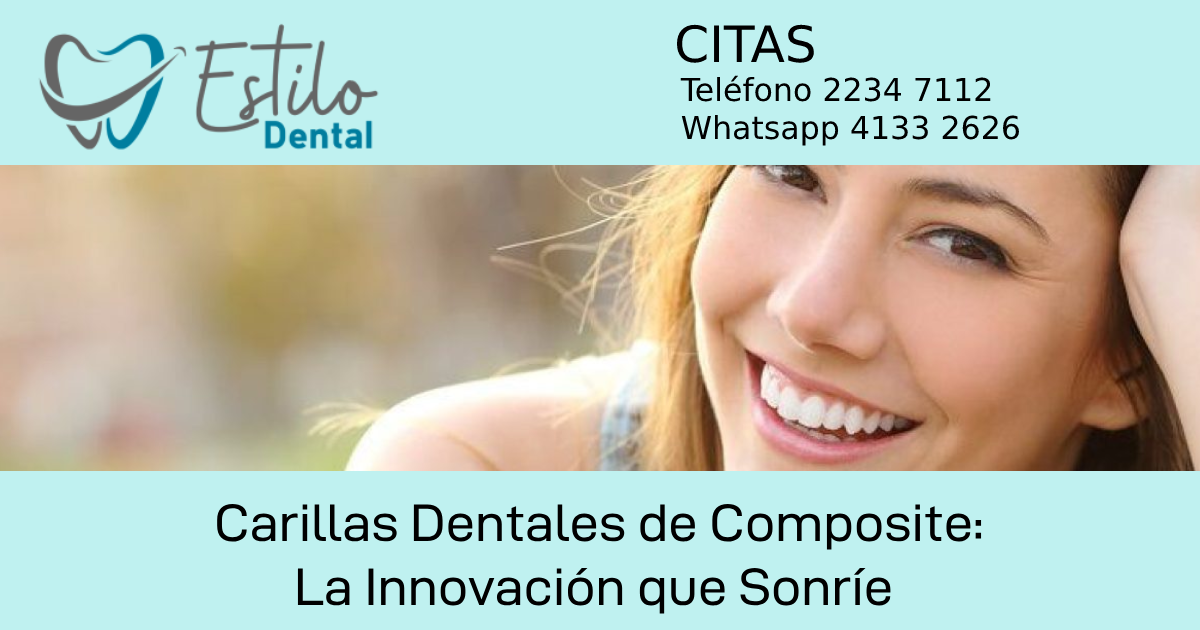 Carillas Dentales de Composite: La Innovación que Sonríe