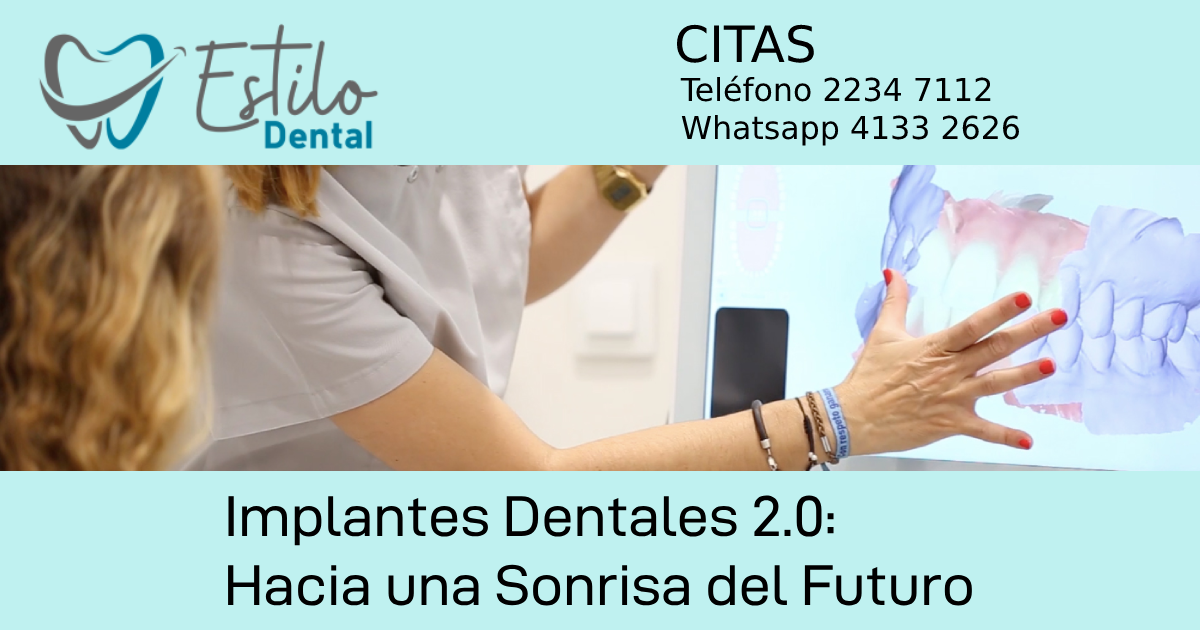 Implantes Dentales 2.0: Hacia una Sonrisa del Futuro