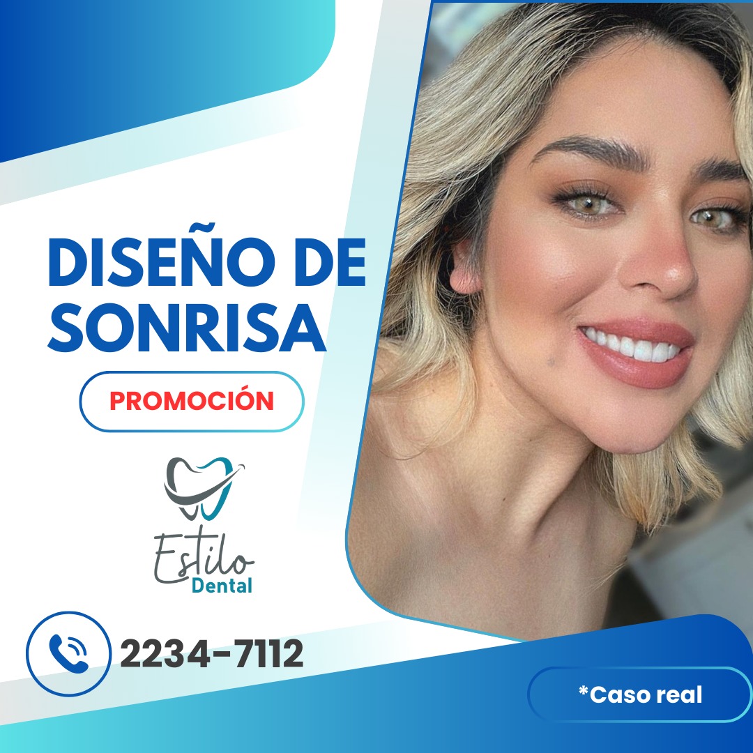 Diseño de Sonrisa