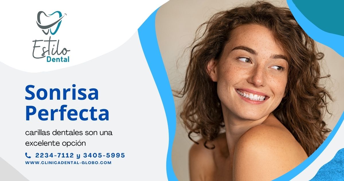 Carillas Dentales: La Mejor Opción para una Sonrisa Perfecta