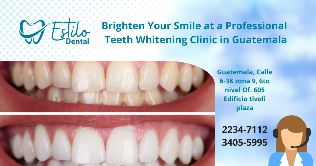 Brighten Your Smile at a Professional Teeth Whitening Clinic in Guatemala
