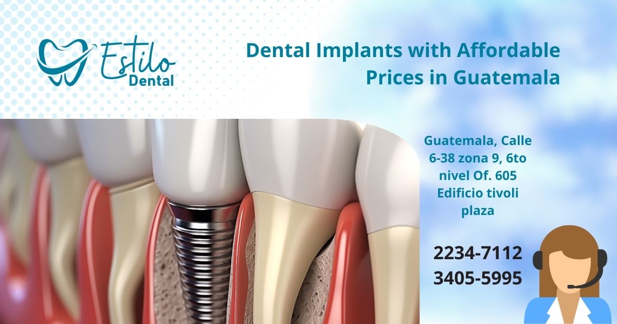 Dental Implants with Affordable Prices in Guatemala